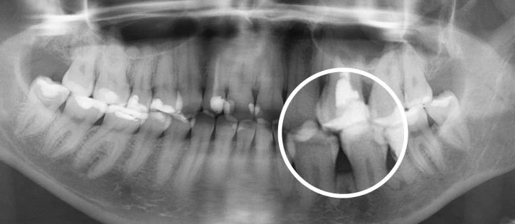 Использование искусственного интеллекта